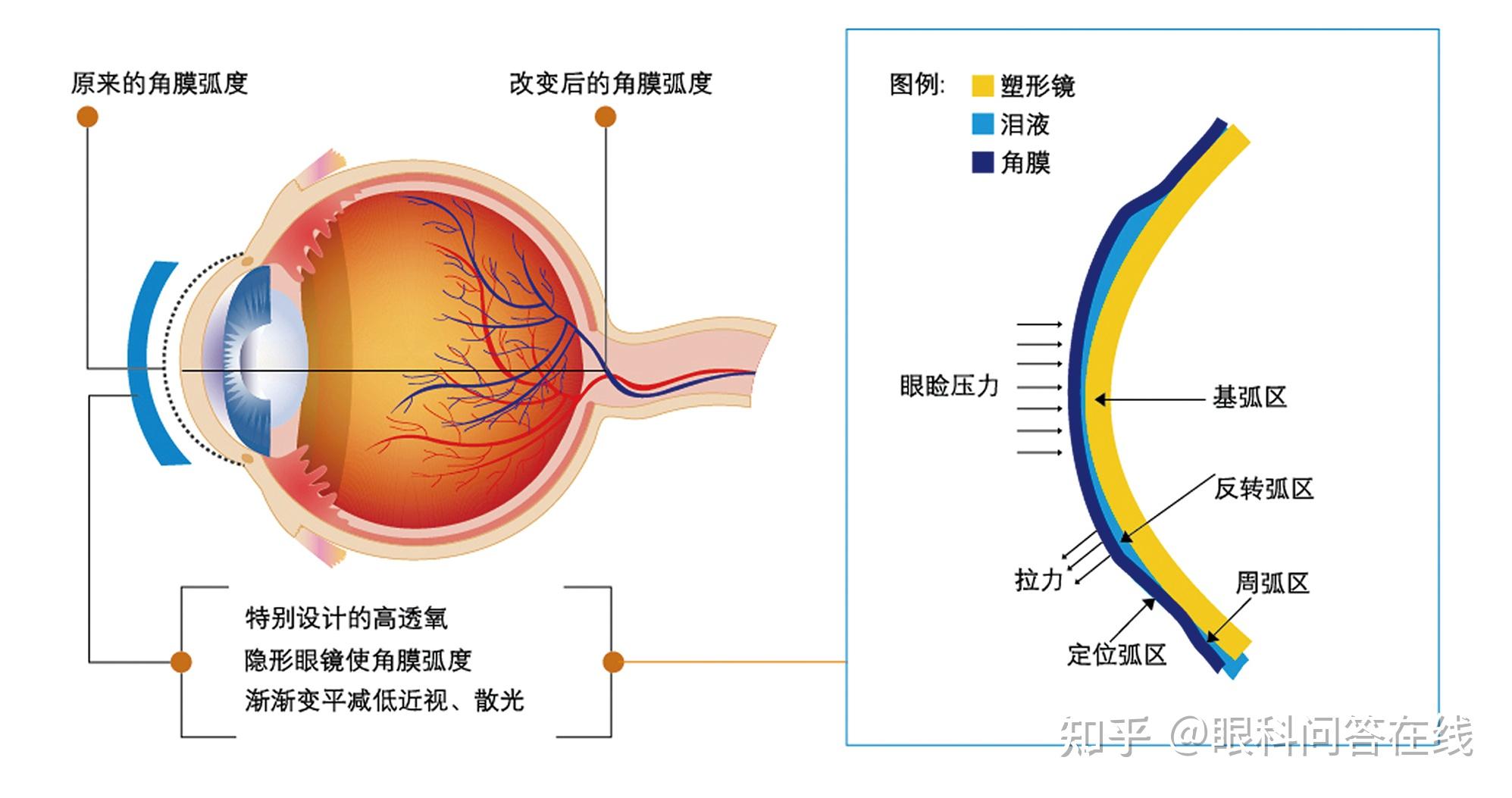 角膜高倍镜图图片