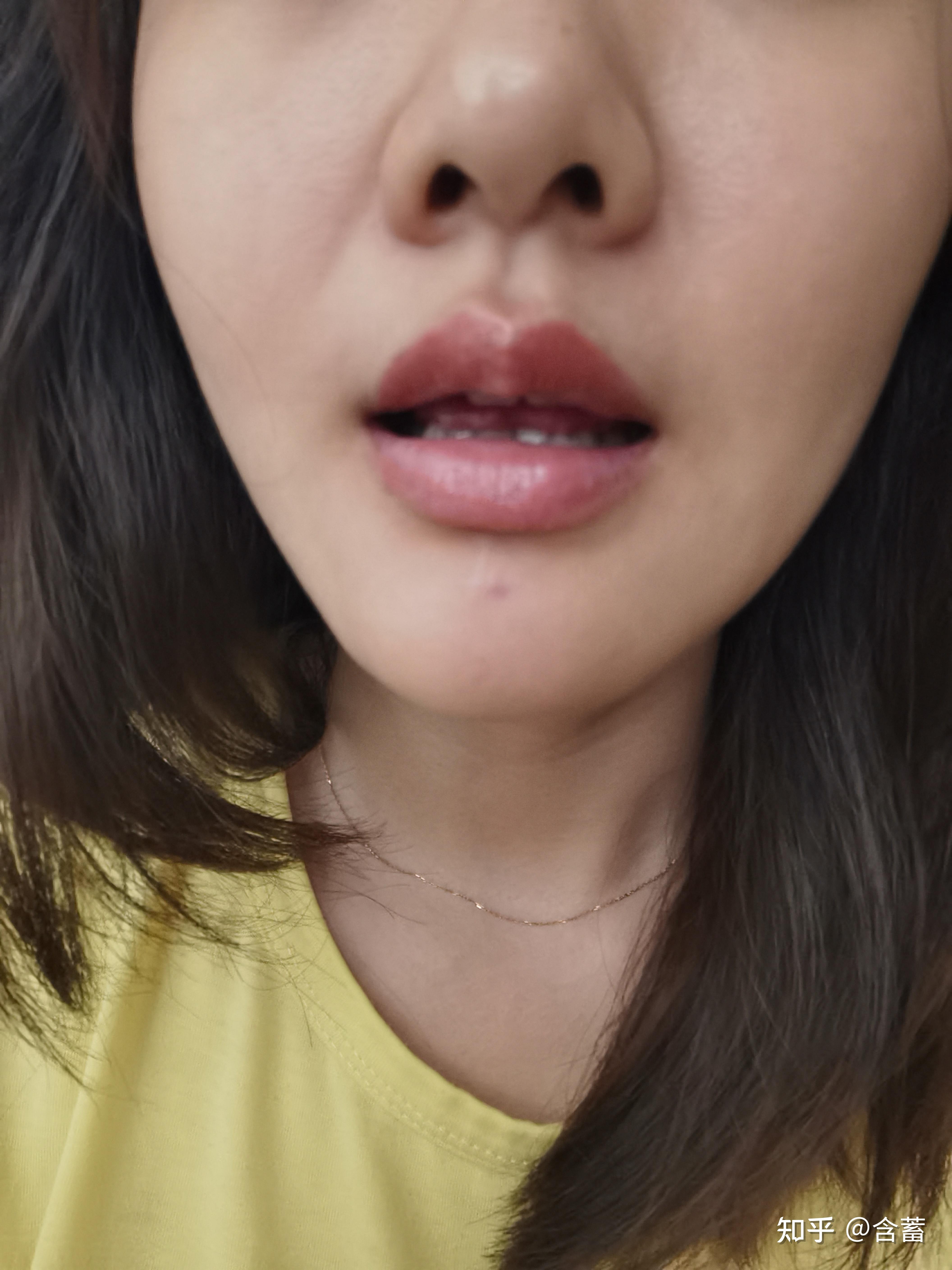纹唇操作如何避免肿胀和实用上色技巧_皮肤