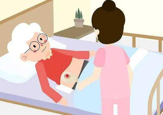 造口发生水肿应该怎么处理?