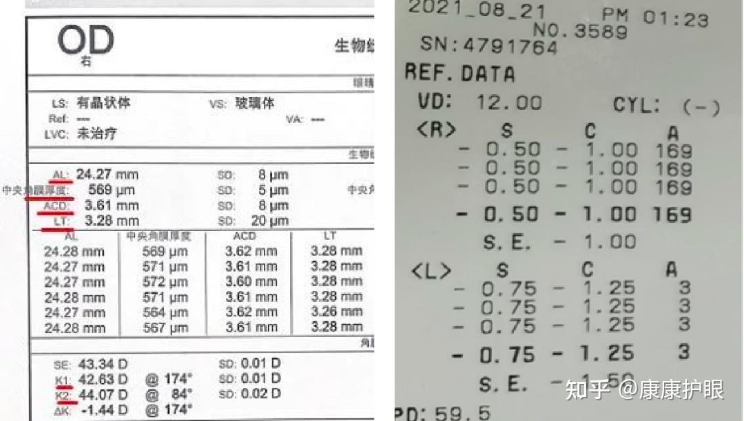 散光度数参考值图片