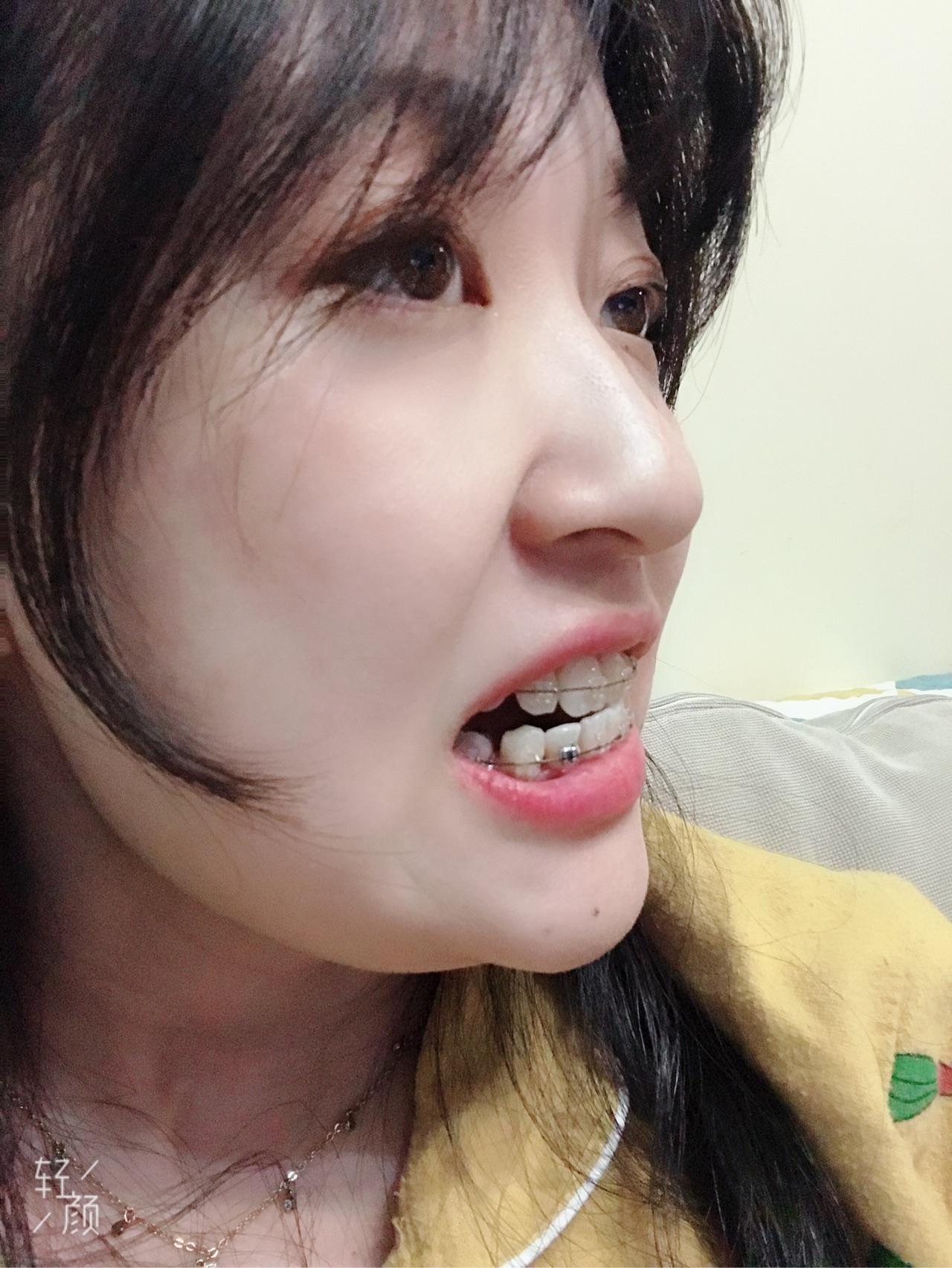 看看这个摇椅弓有啥厉害之处  留念下