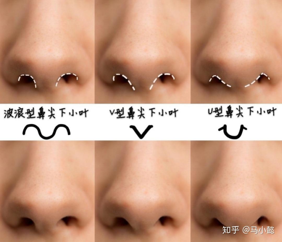 四大常见的鼻尖整形方法都有哪些？ - 知乎