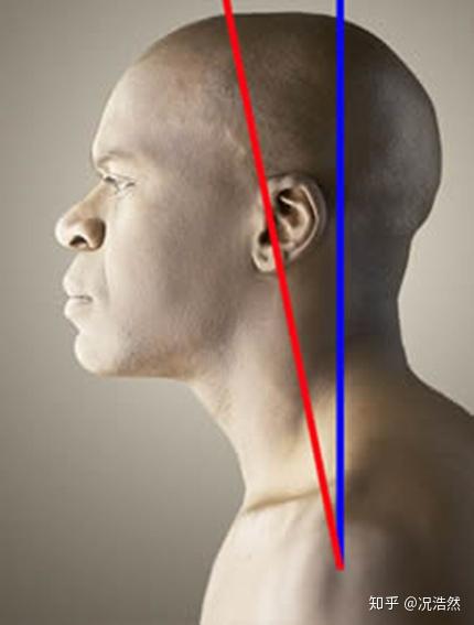 办公族体态改善头前引