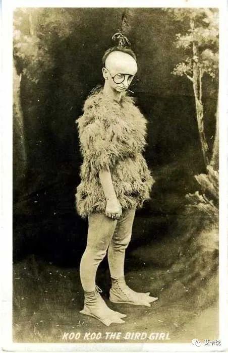 美国猎奇"畸形秀"的疯狂一百年(下) - 知乎