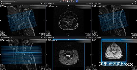 Conquest dicom server настройка windows