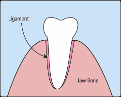 先通过拔除个别牙齿 再用正畸的方法关闭拔牙的牙间隙 让牙齿慢慢排齐