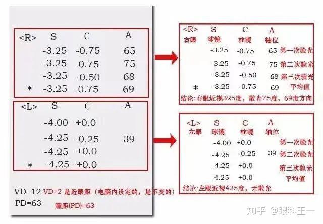 家长带孩子去医院和眼镜店验光,为什么度数完全不一样? - 知乎