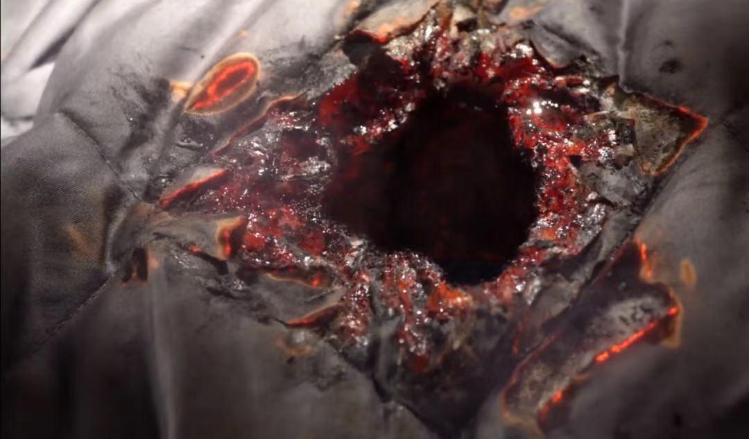 一女子被陨石砸穿肚子,奇迹生还的关键竟然是