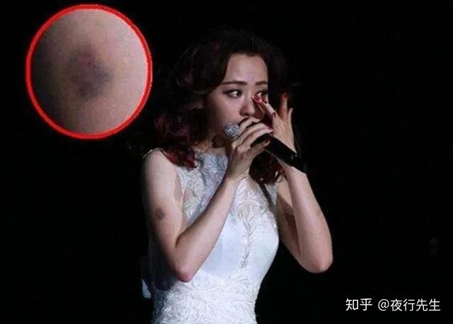 张靓颖的婚姻情况 v2-c100fa4030895de8fa725ff45064fba6_r.jpg