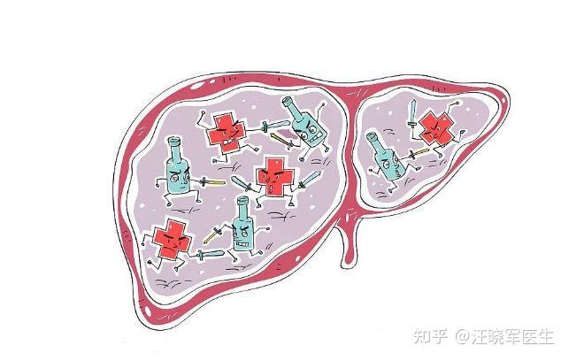 肝纖維化可以活多久藥物治療是否有效更