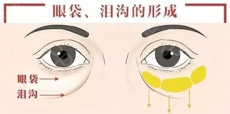 v2-c12c3b67271a15764193baf222fa85d2_1440w.jpg?source=172ae18b