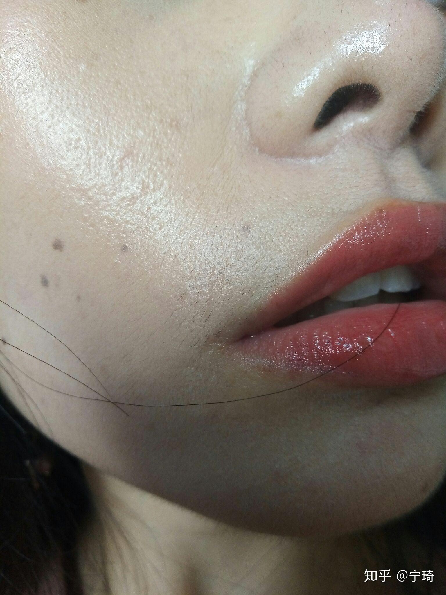脱唇毛记录