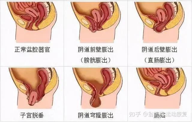 孕期子宫位置图图片