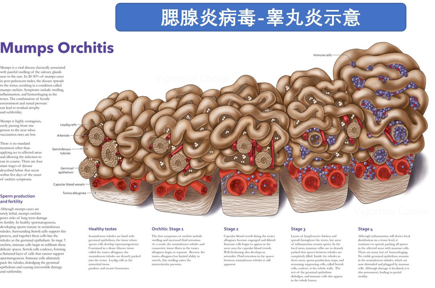腮腺炎病毒结构图图片