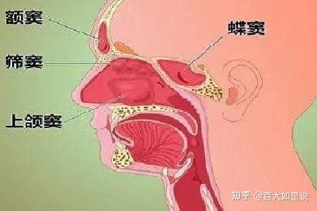 首大陈潜:诊断鼻旁窦发育不良要做那些检查 - 知乎
