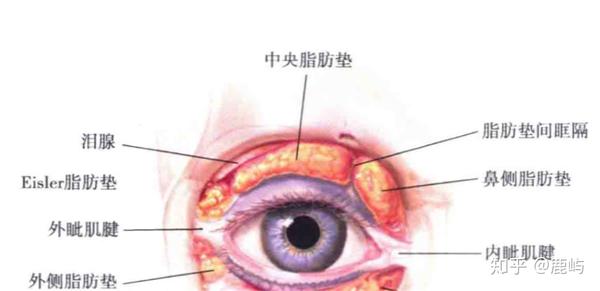 眶隔脂肪在哪里图片