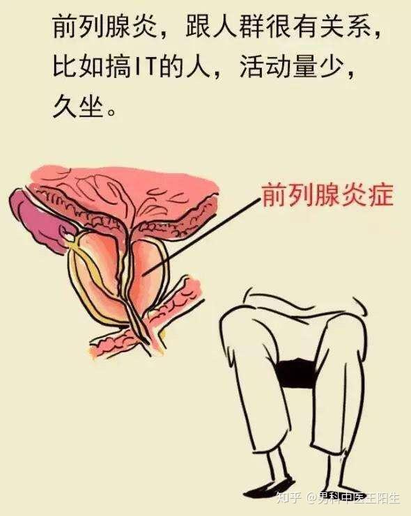 男科圣手徐福松老师治疗慢性前列腺炎经验方萆菟汤