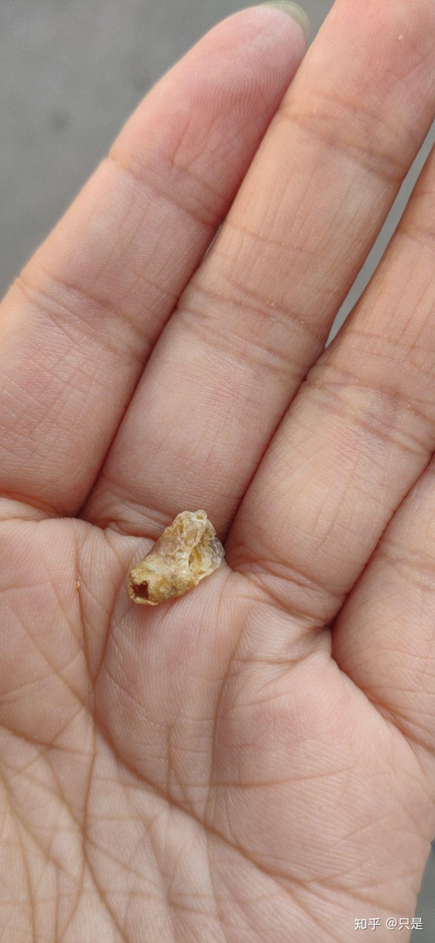 掏出一块超大耳屎,是种什么体验? - 知乎