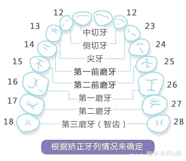 牙齿矫正哪些情况需要拔牙