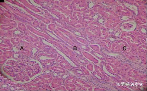 图15-1肾皮质(肾 he染色10×10) 图示肾皮质的皮质迷路(a,c)及中间的
