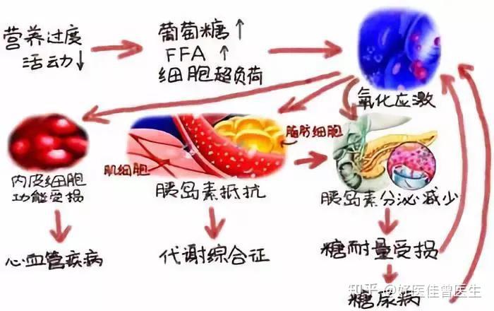 胰岛素抵抗与多囊卵巢图片