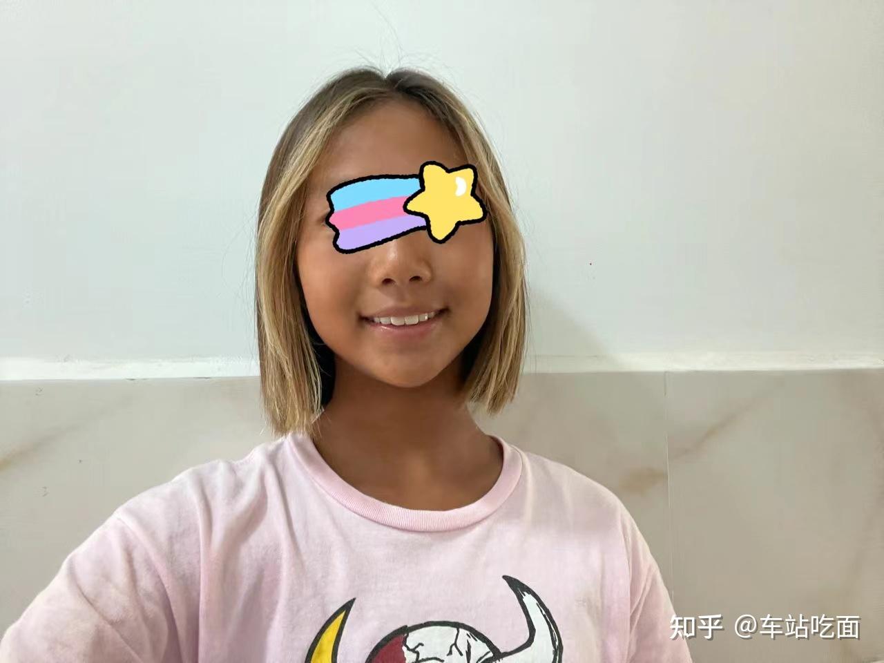 美白精华真的有用吗,夏天晒黑了如何快速白回来? - 知乎