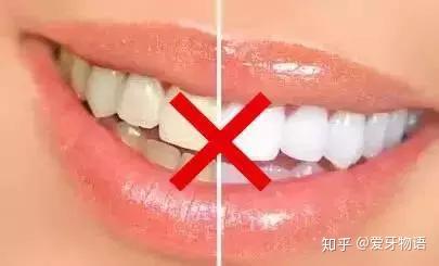 洗牙能让牙变白吗