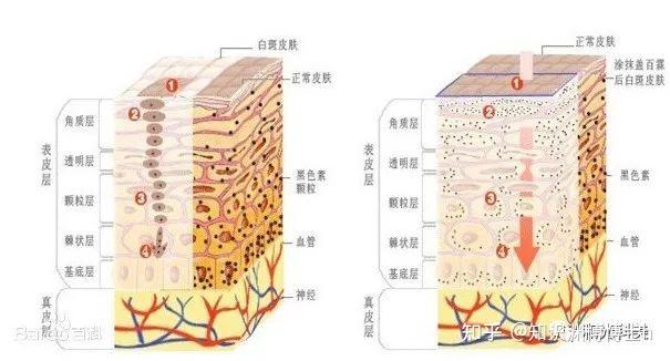 皮膚屏障受損怎麼辦 - 知乎