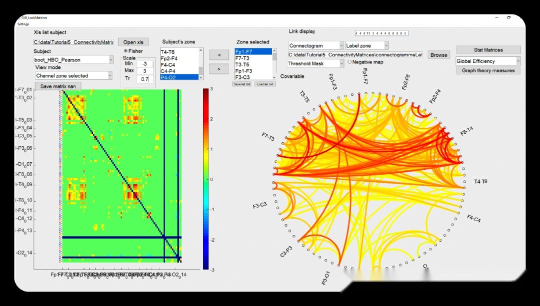 Matlab Spm Model Analysis LIONirs:一款基于SPM灵活用于分析近红外数据的MATLAB工具箱 - 知乎