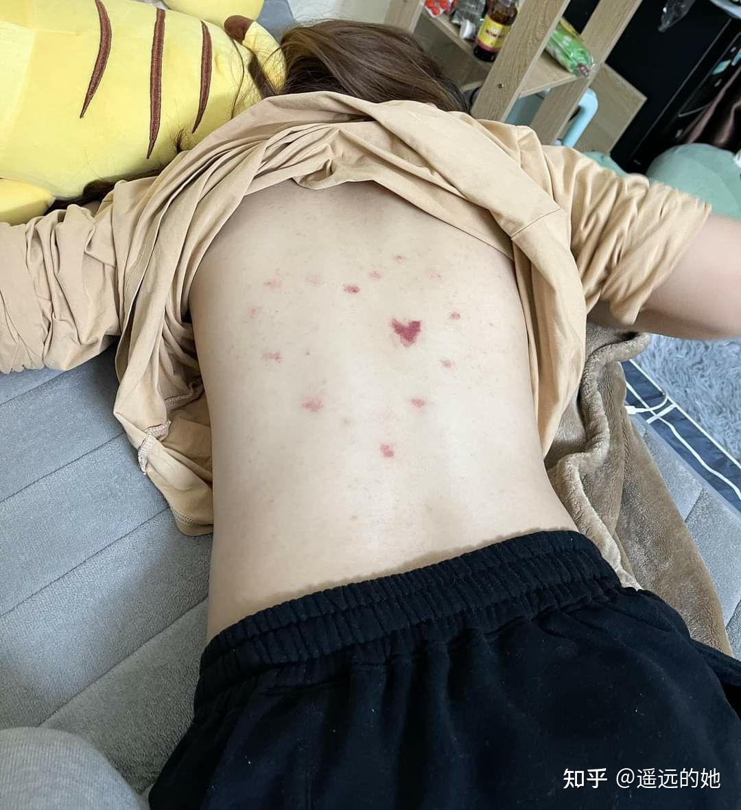 如何种心形的草莓印