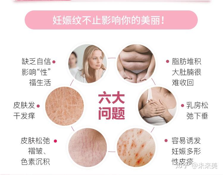 妊娠纹怎样修复才能达到我们的理想效果呢