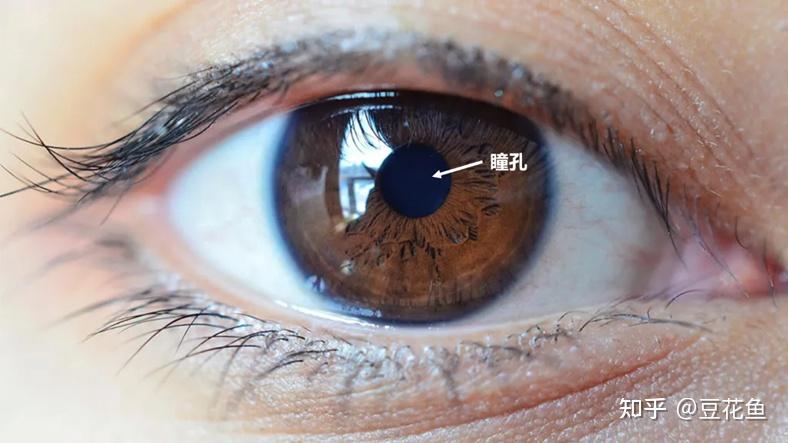 大瞳孔能做近视手术吗? 