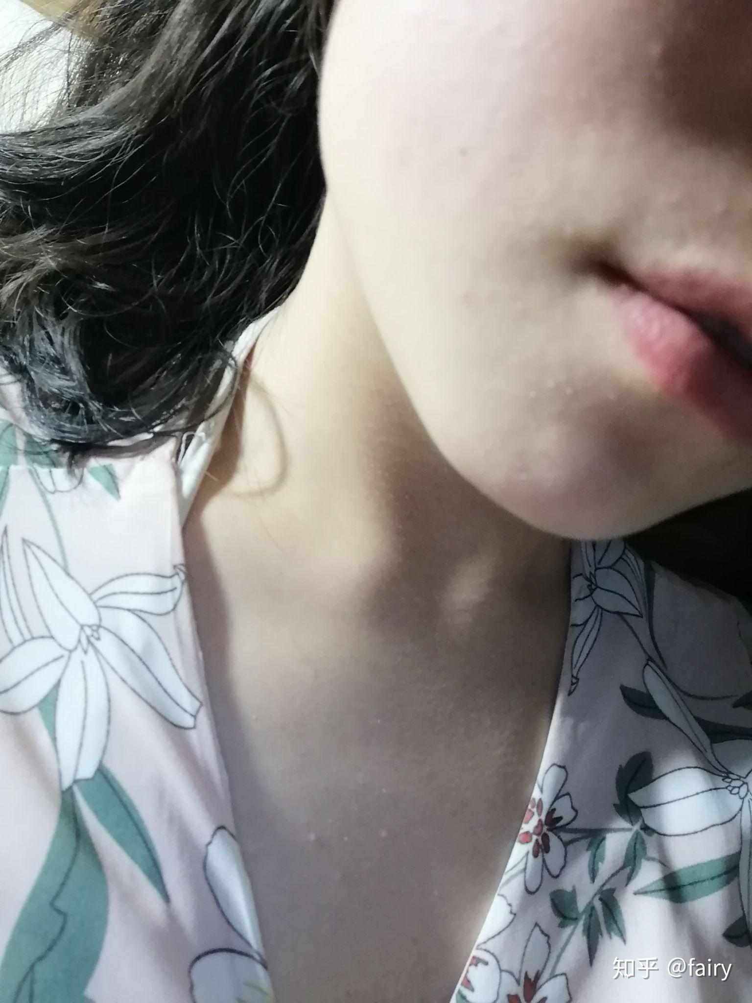 silkn脱毛仪腿毛记录