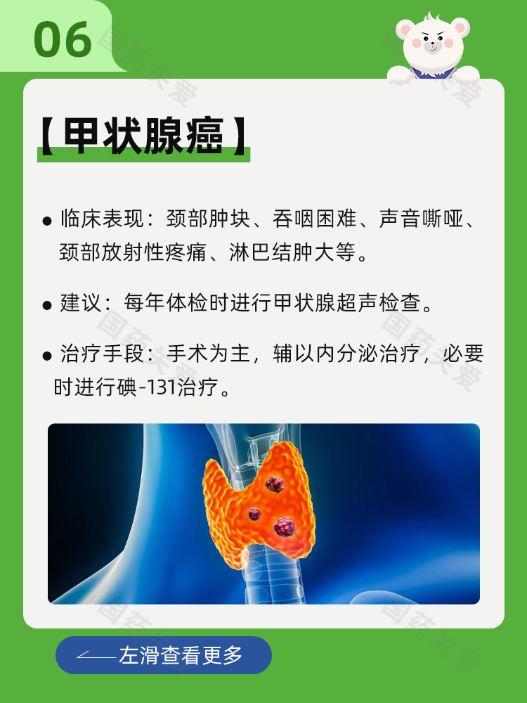 世界头颈癌日丨一文读懂头颈癌 - 知乎