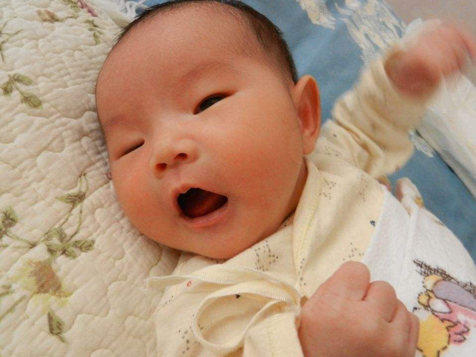 为什么会上眼睑下垂?是什么引起了上眼睑下垂?