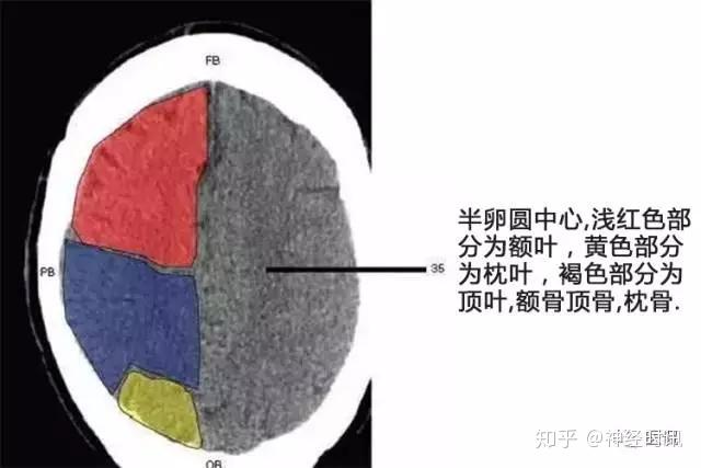 解剖&影像 —— 颅脑CT解剖口诀及彩色解剖图 - 知乎