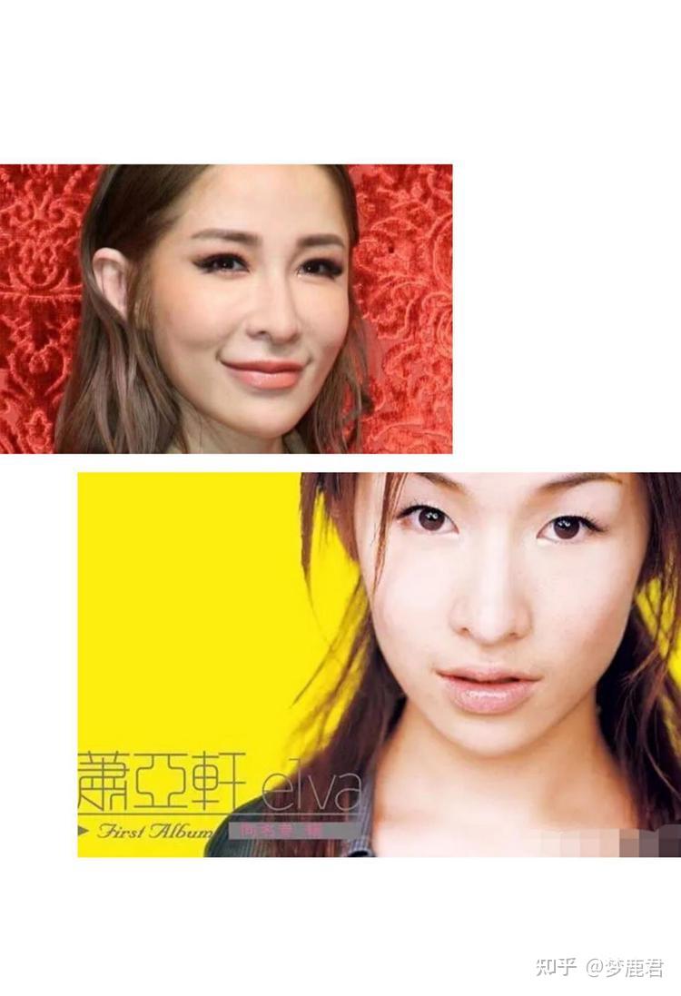 41岁萧亚轩紧急入院,所谓的潇洒小姐,不过都是假象 - 知乎