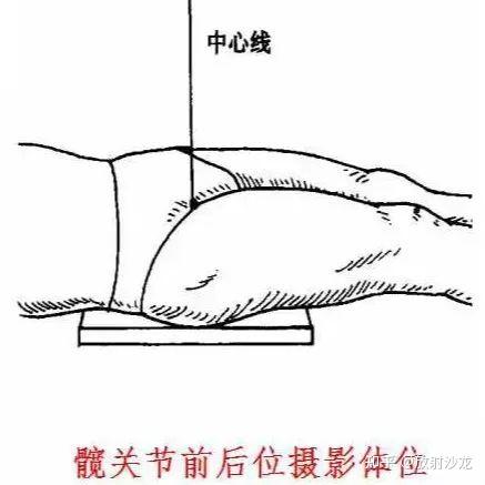 足稍內旋,使兩足趾內側互相接觸;被檢側髂前上棘與恥骨聯合上緣連線