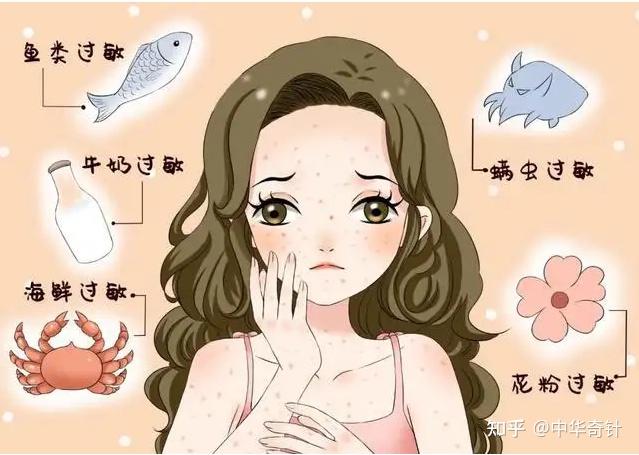 特禀体质——过敏派 - 知乎
