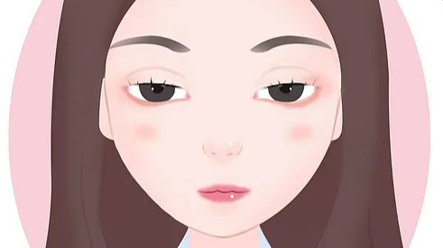 开眼角术后眼睛变丑了是什么原因