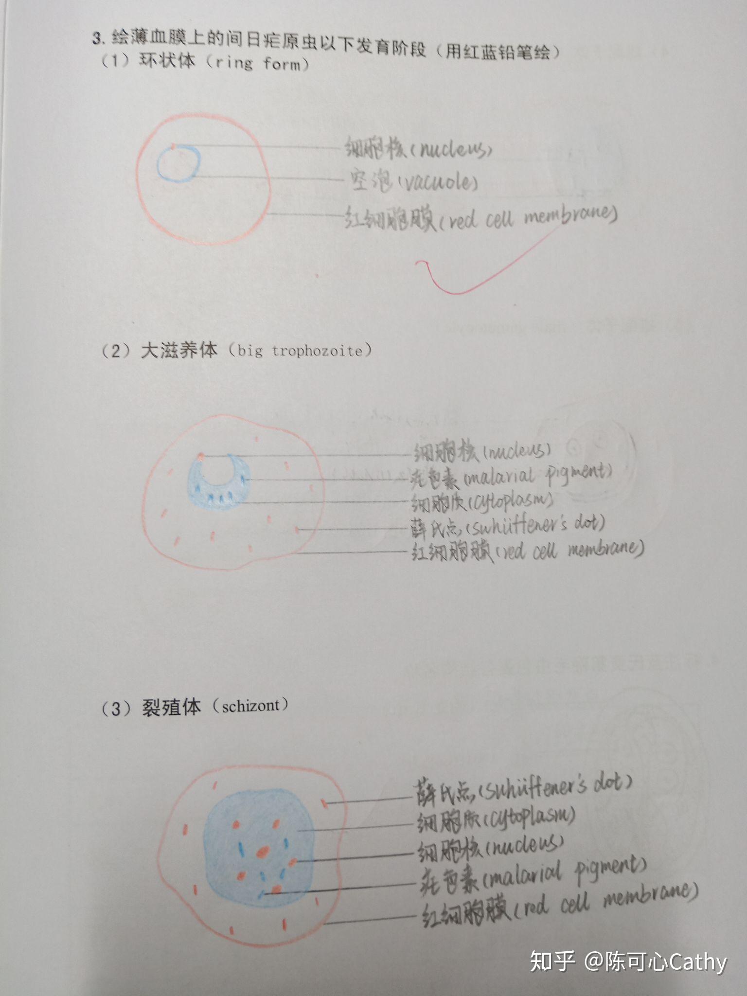 弓形虫滋养体红蓝铅笔图片