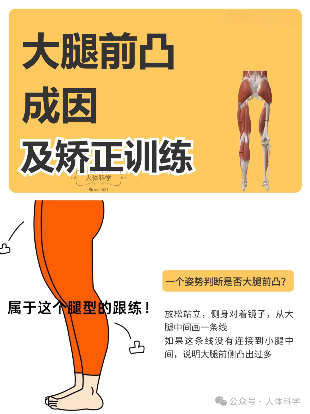 【大腿前凸】大腿粗的成因、评估、矫正思路 - 知乎