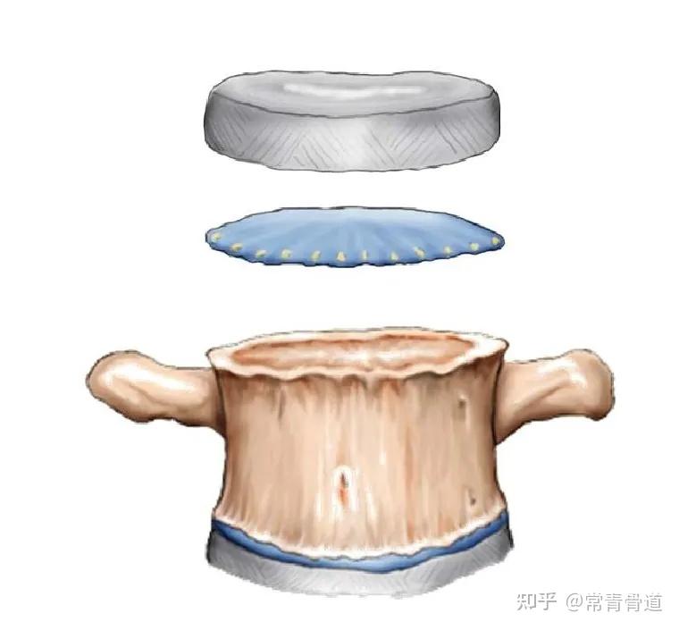 它連接了椎間盤和椎體有一種透明軟骨墊片同時在脊髓和纖維環的上下