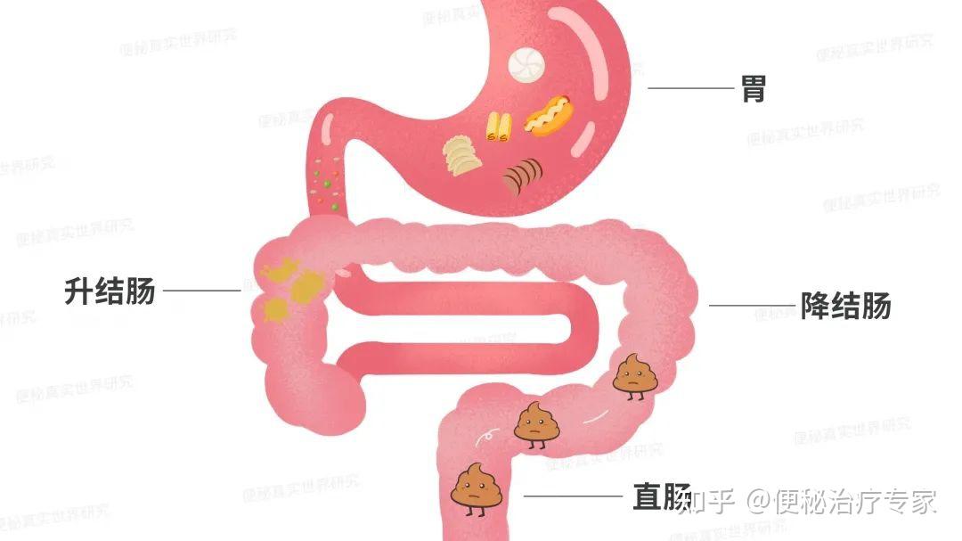 人肠道的位置顺序图片