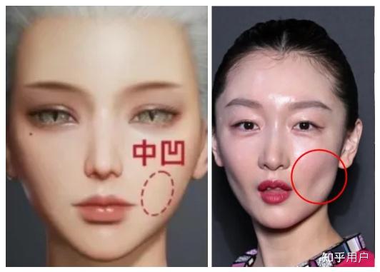 面颊凹陷的原因是什么？如何才能有效改善 - 知乎