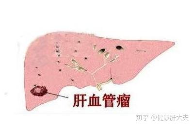 v2-c58f272a41afe8a16afa1bdc0b663736_b.jpg