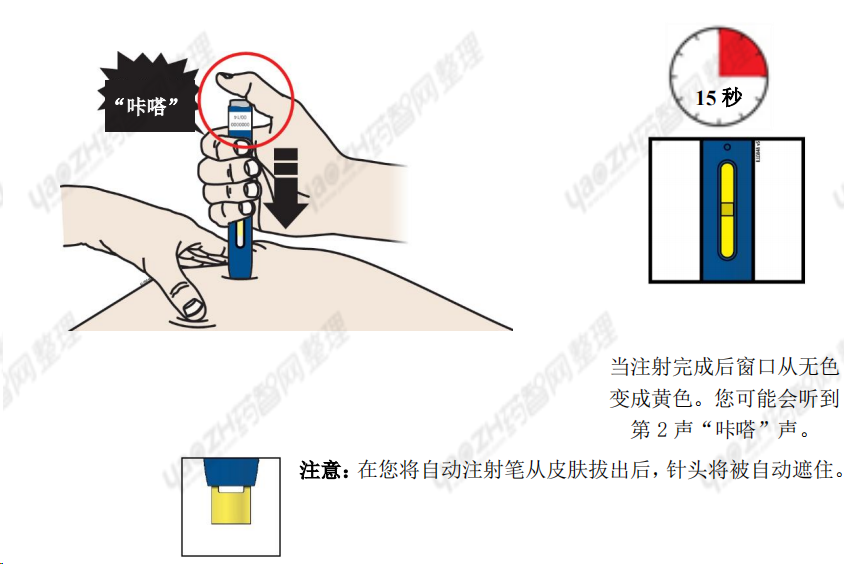 教你正确使用依洛尤单抗注射液(瑞百安) - 知乎