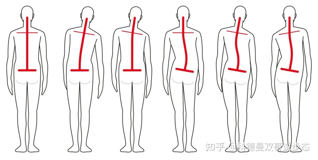 高弓足人群,因行走会破坏人体力学的平衡,从而影响正常身体生理曲度