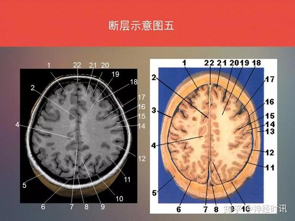 脑功能区及解剖学定位 ( 看到了,你要记得收藏 转发 ) - 知乎