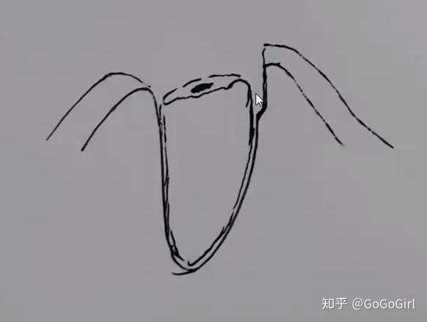 牙挺楔入:骨锤增隙/磨除少量骨质(如图),牙挺与